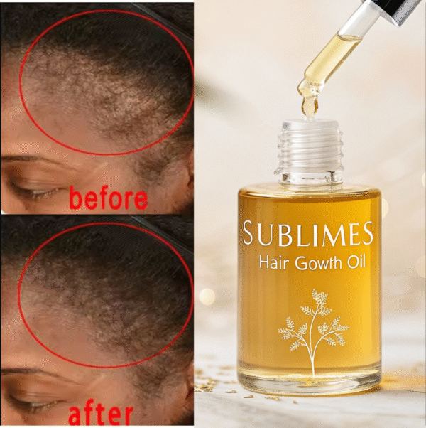Sublimes Hair Growth Oil – 100% Natural & Powerful - Image 4