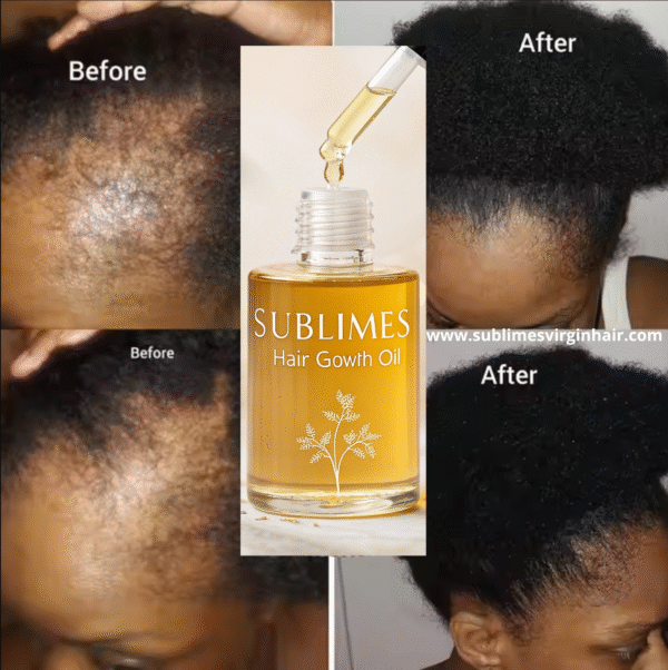 Sublimes Hair Growth Oil – 100% Natural & Powerful - Image 5
